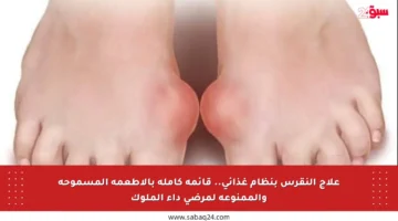 علاج النقرس بنظام غذائي.. قائمة كاملة بالأطعمة المسموحة والممنوعة لمرضى داء الملوك